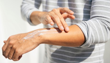 woman applying sunscreen to arm